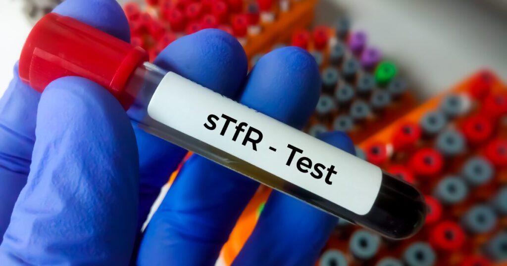 Iron Deficiency Detection Test