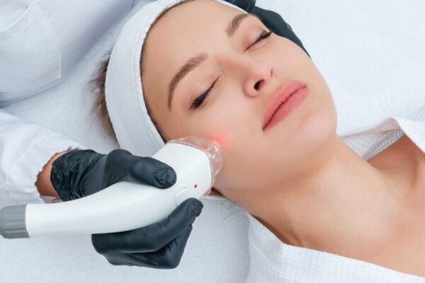 A woman receiving MOXI skin treatment at clinic